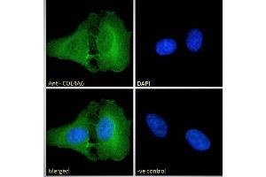 ABIN570771 Immunofluorescence analysis of paraformaldehyde fixed U2OS cells, permeabilized with 0. (COL4a6 Antikörper  (Internal Region))