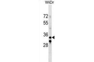 Western Blotting (WB) image for anti-Integrin beta 1 Binding Protein (Melusin) 2 (ITGB1BP2) antibody (ABIN2999936) (ITGB1BP2 Antikörper)