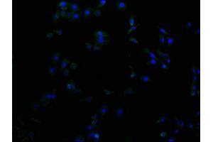 Immunofluorescence staining of A549 cells with ABIN7156172 at 1:100, counter-stained with DAPI. (RHBDF2 Antikörper  (AA 1-200))