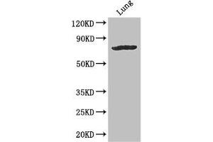 Western Blot Positive WB detected in: Mouse lung tissue All lanes: SLC28A3 antibody at 3 μg/mL Secondary Goat polyclonal to rabbit IgG at 1/50000 dilution Predicted band size: 77, 70 kDa Observed band size: 77 kDa (SLC28A3 Antikörper  (AA 1-102))