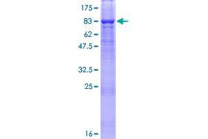 SPINT1 Protein (AA 1-513) (GST tag)