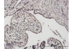 Immunostaining (ISt) image for anti-Upstream Binding Transcription Factor, RNA Polymerase I (UBTF) (AA 551-650) antibody (ABIN521228)