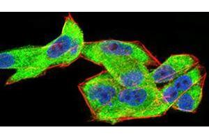 Immunofluorescence (IF) image for anti-Complement Factor H-Related 5 (CFHR5) (AA 344-569) antibody (ABIN5542640)