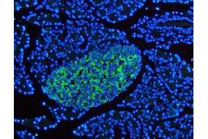 IF analysis of SYP using anti-SYP antibody (ABIN3042768). (Synaptophysin Antikörper  (N-Term))