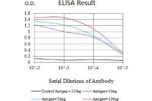 Black line: Control Antigen (100 ng),Purple line: Antigen (10 ng), Blue line: Antigen (50 ng), Red line:Antigen (100 ng) (Cytokeratin 18 Antikörper  (AA 1-150))