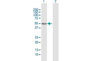 Western Blot analysis of GALK2 expression in transfected 293T cell line by GALK2 MaxPab polyclonal antibody. (GALK2 Antikörper  (AA 1-458))