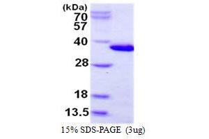 Image no. 1 for Charged Multivesicular Body Protein 6 (CHMP6) protein (His tag) (ABIN1098261)