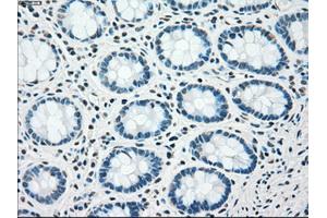 Immunohistochemical staining of paraffin-embedded pancreas tissue using anti-CHEK2mouse monoclonal antibody. (CHEK2 Antikörper)