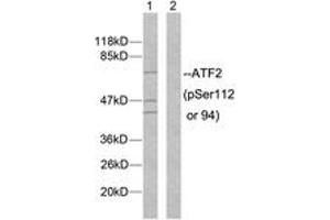 Western blot analysis of extracts from MDA-MB-435 cells, using ATF2 (Phospho-Ser112 or 94) Antibody. (ATF2 Antikörper  (pSer112))
