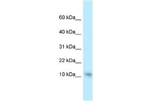 WB Suggested Anti-Nme1 Antibody Titration: 1.