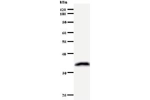 Western Blotting (WB) image for anti-Kinesin Family Member 2C (KIF2C) antibody (ABIN931054) (KIF2C Antikörper)