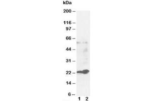 Western blot testing of GST pi antibody and Lane 1:  MCF-7 (Glutathione S Transferases pi Antikörper)