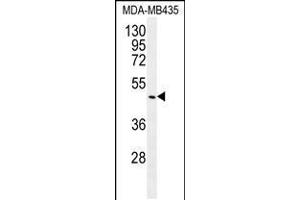 Western blot analysis in MDA-MB435 cell line lysates (35ug/lane). (GDF5 Antikörper  (C-Term))