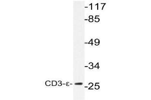 Western blot (WB) analysis of CD3-epsilon antibody in extracts from K562 cells. (CD3 Antikörper)