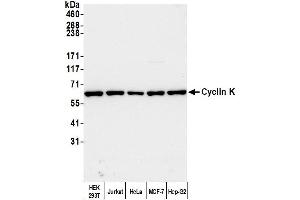 Western Blotting (WB) image for anti-Cyclin K (CCNK) (AA 530-580) antibody (ABIN7453581)
