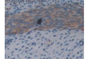 Detection of FIL1d in Mouse Uterus Tissue using Polyclonal Antibody to Interleukin 1 Delta (FIL1d) (FIL1d Antikörper  (AA 1-156))