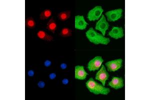 Phospho-MCM2 (Ser41) Antibody staining Hela cells by IF/ICC. (MCM2 Antikörper  (pSer41))