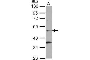 WB Image Sample (30 ug of whole cell lysate) A: NT2D1 10% SDS PAGE antibody diluted at 1:500 (NR6A1 Antikörper  (C-Term))
