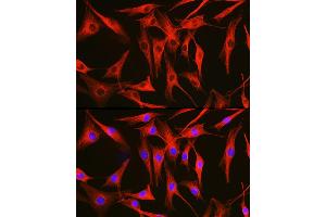Immunofluorescence analysis of NIH/3T3 cells using Alpha-tubulin (ubiquitous) chain antibody (ABIN7271033) at dilution of 1:100. (TUBA1B Antikörper  (AA 1-451))