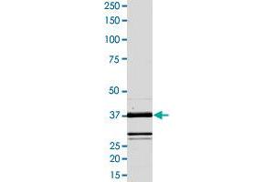 Image no. 2 for V-Raf-1 Murine Leukemia Viral Oncogene Homolog 1 (RAF1) (AA 306-648), (Tyr340Asp-Mutant), (Tyr341Asp-Mutant) (Active) protein (ABIN5569962) (RAF1 Protein (AA 306-648, Tyr340Asp-Mutant, Tyr341Asp-Mutant))