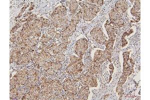 IHC analysis of LPP using anti-LPP antibody (ABIN7599606). (LPP Antikörper  (AA 10-572))