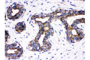 Immunohistochemistry (Paraffin-embedded Sections) (IHC (p)) image for anti-Cell Division Cycle 6 Homolog (S. Cerevisiae) (CDC6) (AA 147-549) antibody (ABIN3043500) (CDC6 Antikörper  (AA 147-549))