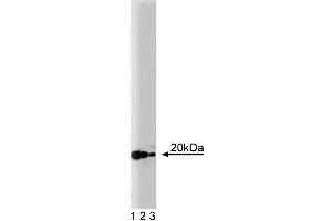 Western blot analysis of ARF-3 on a rat cerebrum lysate. (ARF3 Antikörper  (AA 1-181))