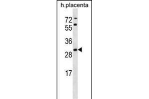 STARD4 Antibody (N-term) (ABIN656728 and ABIN2845952) western blot analysis in human placenta tissue lysates (35 μg/lane). (STARD4 Antikörper  (N-Term))