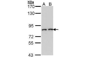 WB Image Sample (30 ug of whole cell lysate) A: Hep G2 , B: Molt-4 , 7. (FAP Antikörper)