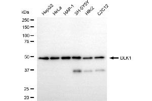 Western blotting analysis using DLK1 antibody (ABIN7798305).