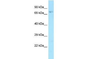 WB Suggested Anti-HAUS3 Antibody Titration: 1. (HAUS3 Antikörper  (Middle Region))