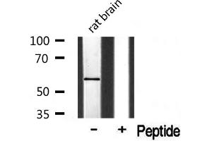 Western blot analysis of Cytochrome P450 1A2 Antibody expression in rat brain tissue lysates. (CYP1A2 Antikörper  (Internal Region))