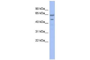 GNL3 antibody used at 1 ug/ml to detect target protein. (Nucleostemin Antikörper)