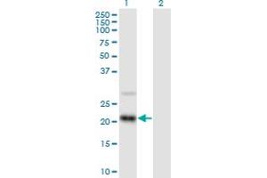 Western Blot analysis of RAX2 expression in transfected 293T cell line by RAX2 MaxPab polyclonal antibody. (RAX2 Antikörper  (AA 1-184))