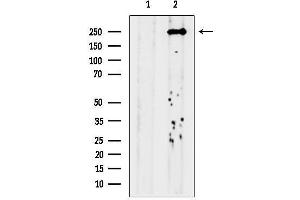anti-Polymerase (DNA Directed), theta (POLQ) (Internal Region) antibody