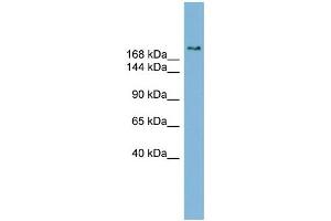 WB Suggested Anti-SETBP1 Antibody Titration:  0. (SETBP1 Antikörper  (Middle Region))