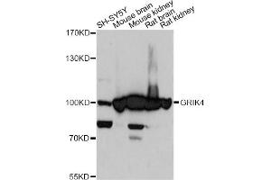 Western blot analysis of extracts of various cell lines, using GRIK4 antibody. (GRIK4 Antikörper)