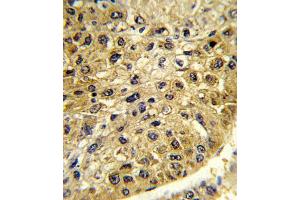 Immunohistochemistry (IHC) image for anti-Dopachrome Tautomerase (DCT) antibody (ABIN3003902) (DCT Antikörper)