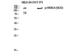 Western Blot (WB) analysis of HeLa, SH-SY5Y, 3T3 lysis using Phospho-HDAC4 (S632) antibody.