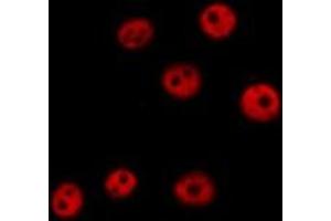 ABIN6279426 staining  HeLa cells by IF/ICC. (KHSRP Antikörper  (N-Term))
