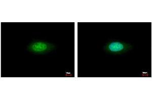 ICC/IF Image Annexin VII antibody detects ANXA7 protein at cytoplasm and nucleus by immunofluorescent analysis. (Annexin VII Antikörper)