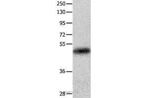 Western blot analysis of Human colon cancer tissue, using KRT23 Polyclonal Antibody at dilution of 1:100 (KRT23 Antikörper)