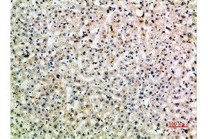 Immunohistochemistry (IHC) image for anti-C-Type Lectin Domain Family 4, Member M (CLEC4M) (AA 271-320) antibody (ABIN7189476)