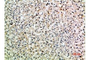 Immunohistochemical analysis of paraffin-embedded human-liver, antibody was diluted at 1:200 (C-Type Lectin Domain Family 4, Member M (CLEC4M) (AA 271-320) Antikörper)