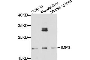 Western blot analysis of extract of various cells, using IMP3 antibody. (IMP3 Antikörper)