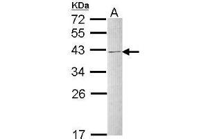 Western blot analysis of 30 ug of whole cell lysate (A: Raji) using a 12 % SDS PAGE gel and hnRNP C1/C2 antibody at a dilution of 1:1000 (HNRNPC Antikörper)