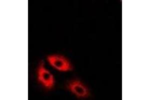 Immunofluorescent analysis of MDH2 staining in U2OS cells. (MDH2 Antikörper)