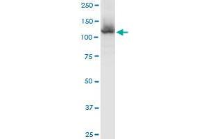 Western Blotting (WB) image for anti-Huntingtin Interacting Protein 1 Related (HIP1R) (AA 1-1068) antibody (ABIN522471)