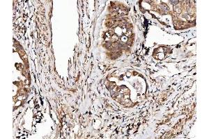 IHC analysis of Angiogenin/ANG using anti-Angiogenin/ANG antibody (ABIN4886457). (ANG Antikörper  (AA 25-147))