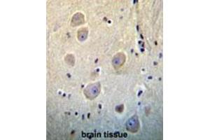 Immunohistochemistry (Paraffin-embedded Sections) (IHC (p)) image for anti-Ras Homolog Gene Family, Member B (RHOB) (AA 103-137), (Middle Region) antibody (ABIN954540)